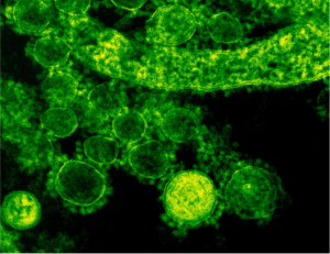 Conference on Biomolecular Simulations: Apply now