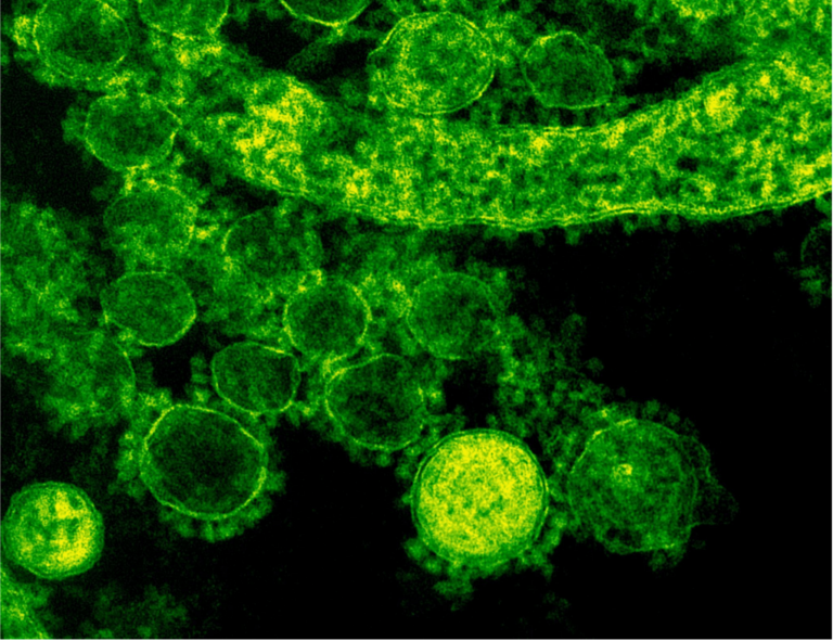 Conference on Biomolecular Simulations: Apply now